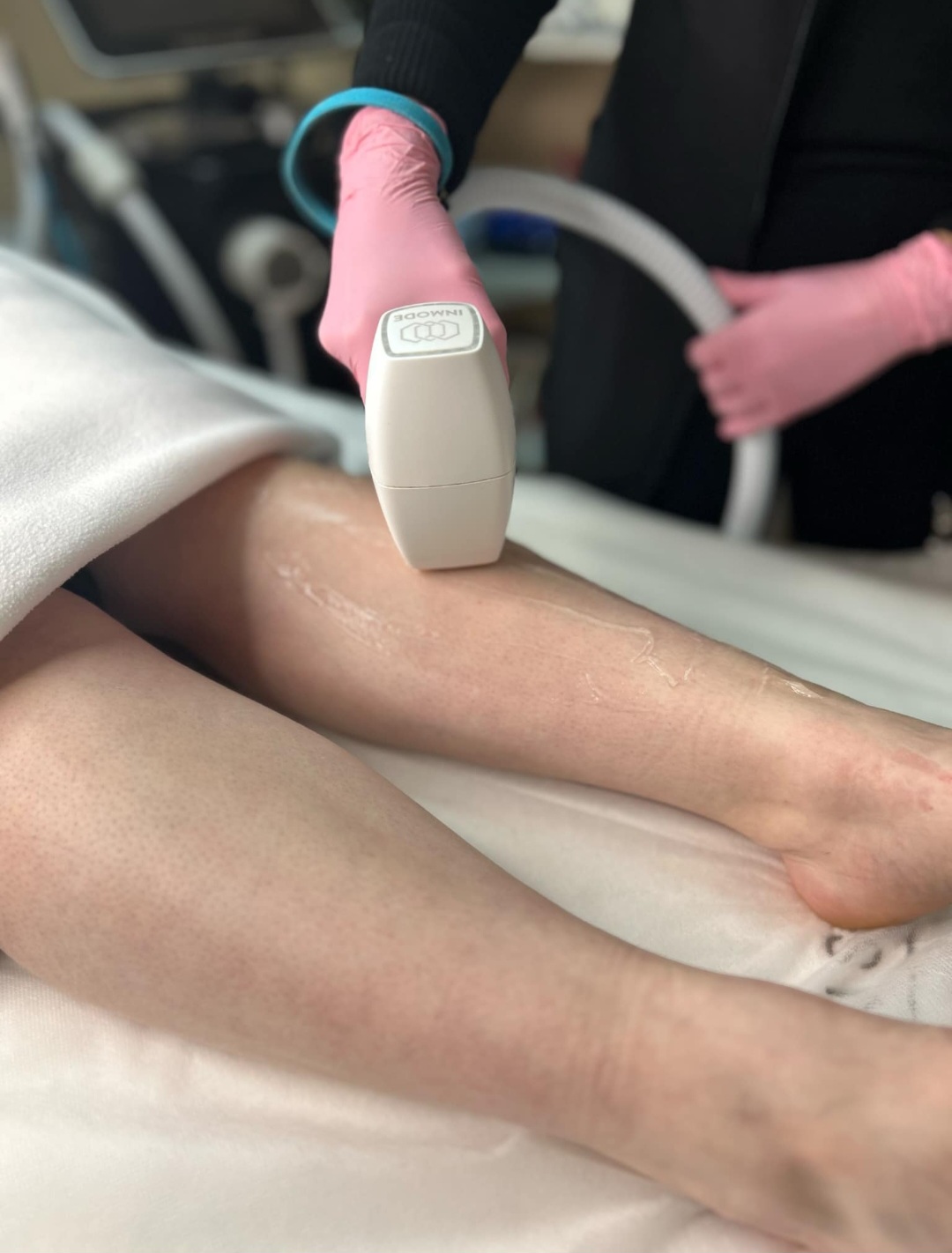 Épilation au laser - Salon Jodia